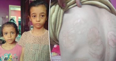 والد طفلتى المرج ضحيتى التعذيب: طلقت زوجتى المتهمة