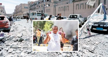 هنا اليمن من القاهرة " الحلقة الثانية".. مصابو الحرب.. أجساد تحمل أوجاع الوطن .. "يوسف": ذهبت لزيارة خالى فانفجر فى لغم أفقدنى ساقى وتقبلت الإصابة لأنها ضريبة الحرب.. "محمد": قذيفة هاون قطعت يدى