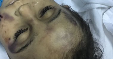 صور.. ربة منزل تعذب طفلها حتى الموت بمساعدة عشيقها فى الدقهلية