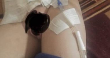 والد الطفل المبتور عضوه بالمنوفية: ساومونى بالمال للتنازل عن حق ابنى فرفضت