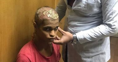 محافظ سوهاج يكلف مديرية الصحة بعلاج طفل مصاب بمرض جلدى