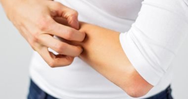 8 عادات خاطئة تعرضك للعدوى بالأمراض الجلدية المختلفة.. أبرزها التقبيل عند التحية 