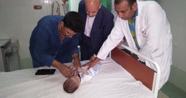صحة الشرقية تستقبل رضيع الإسماعيلية لإجراء جراحة تجميل فى الشفتين