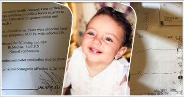 طاعون العصر.. "خديجة" طفلة فى عمر الزهور مصابة بضمور فى العضلات تحتاج لـ"حقن" فى الخارج بـ 150 ألف دولار.. والدتها: "نفسى بنتى تتعالج قبل ما تحصل أخوها.. وتناشد أهل الخير و وزارة الصحة إنقاذها