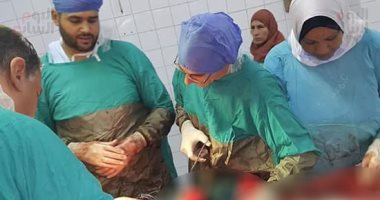 صور.. فريق طبى بالشرقية ينجح فى استئصال ورم من سيدة وزنه 20 كيلوجراما