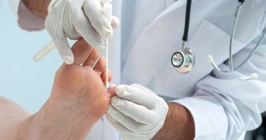 علاج مسمار القدم بطرق مختلفة منها زيت الخروع