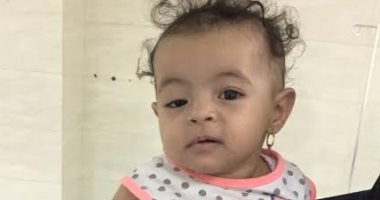 نجاح جراحة تجميل عيون لطفلة عمرها 6 شهور بمستشفى رأس سدر بجنوب سيناء