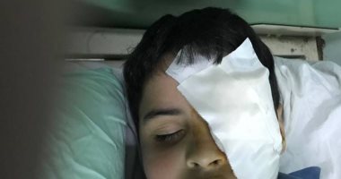 أسرة تلميذ فقئت عينه بالشرقية تتقدم ببلاغ ضد مديرة المدرسة بسبب الإهمال