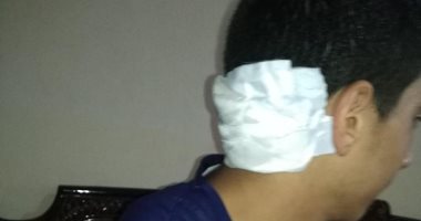 صور.. مدير مدرسة صناعية يعتدى بالضرب على طالب بآلة حادة فى البحيرة