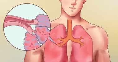اعراض جلطة الرئة وطرق علاجها