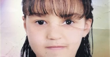 جراحة ناجحة لغلق ثقب بقلب طفلة قطره 2.5 سم فى مستسفى بنى سويف الجامعى