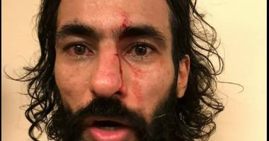 لاعب الاتحاد يواجه شبح الإيقاف بعد اعتدائه على حسين عبد الغنى بالدورى السعودى