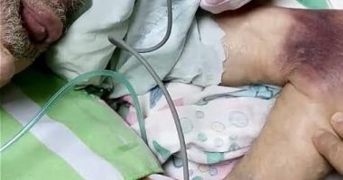 ربة منزل تحرر محضر ضد مستشفى الزقازيق الجامعى للإهمال فى علاج والدها المسن