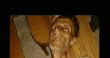 بعد حصار  مليشيات الحوثى..الجوع يقتل أسرة يمنية بالحديدة
