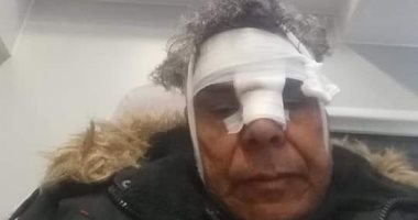 عناصر الإرهابية يعتدون على رئيس الجالية المصرية بوقفة دعم الرئيس فى ألمانيا