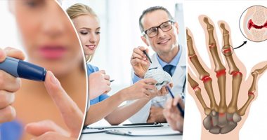 حتى الأمراض كدابة ..3 مشاكل صحية مزمنة أعراضها خادعة.. احمرار وألم المفصل مش شرط يكون نقرس.. ونقص هرمون الفازوبريسين فى الجسم يعرضك لسكر كاذب.. ومرضى السمنة يعانون من ورم "مش حقيقى".. ونصيحة طبية "بلاش تتوهم" 
