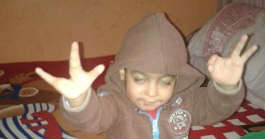 أبو المعاطى طفل من كفر الشيخ: نفسى أعمل عملية فى رجلى علشان أمشى "صور"