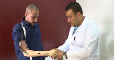 توفير أطراف صناعية لـ16 نزيلا من ذوى الاحتياجات الخاصة بسجون برج العرب 