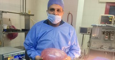 صور.. استئصال ورم يزن 14 كيلو جرام من رحم سيدة بكفر الشيخ 