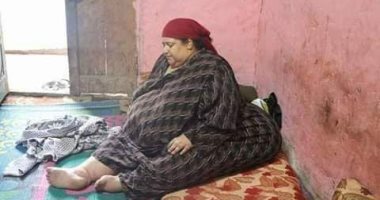 الحاجة انتصار تناشد رئاسة الوزراء علاجها على نفقة الدولة من داء الفيل