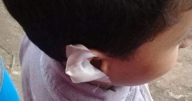 تلميذ يتعدى على زميله بالمنوفية بشفرة حلاقة بسبب سندوتش