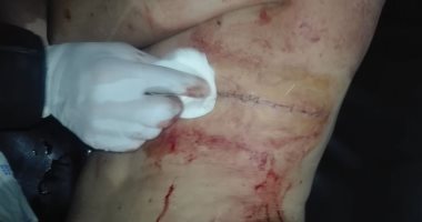 صور.. سائق يعتدى على شخصين بمطواة أثناء سيرهما فى جنازة بالشرقية