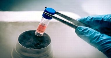 متى يلجأ الرجل لتجميد الحيوانات المنوية ؟ 