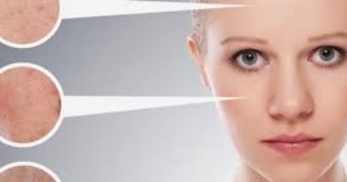 إذا كانت بشرتك جافة.. نصائح طبية بسيطة هترطبها وترجع نضارتها