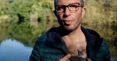 على طريقة "آيرون مان".. رجل يضع شريحة بلوتوث فى صدره