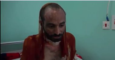 فيديو.. الحوثيون ارتكبوا جرائم تعذيب ألف يمنى باستخدام حمض الأسيد