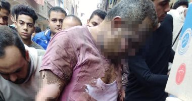 إصابة عامل بحروق فى الوجه والجسد بسبب انفجار كابينة كهرباء بالقليوبية