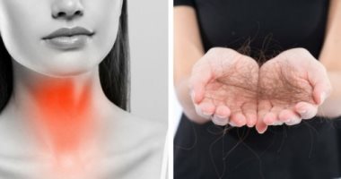 لو عندك مشكلة فى الغدة الدرقية.. 8 أشياء لمنع تساقط الشعر