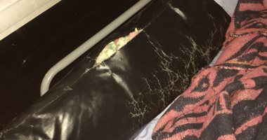 شكوى من وجود حشرات زاحفة فى مستشفى زاوية الناعورة المركزى بالمنوفية