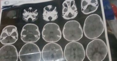 قارئة تطلب مساعدتها فى توفير علاج وملابس شتوية لأولادها