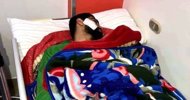 صورة .. عملية جراحية فى وجه صانع ألعاب طنطا ويغيب عن الملاعب أسبوعين