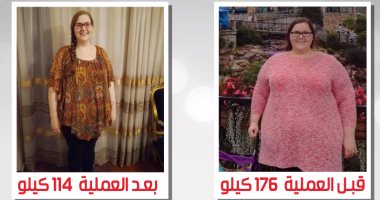 قصة فتاة أمريكية نجحت فى القضاء على السمنة مع دكتور أحمد السبكى.. اعرف التفاصيل