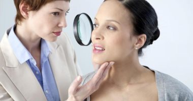 علاج الكلف بطرق مختلفة منها الأدوية 