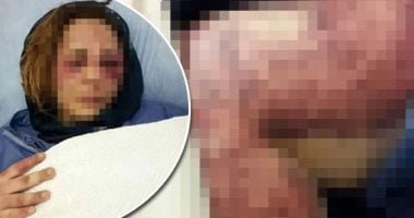 زوج يعذب زوجته 3 أيام متواصلة بأسلاك الكهرباء والسكين بسبب الشك.. الزوجة: "وقفت ضد أهلى عشان أتجوزه وجردنى من ملابسى وتفنن فى تعذيبى أمام ابنى".. وتؤكد: "هددنى بقتل أمى لو زرتها".. والدها ينقذها من الموت.. صور