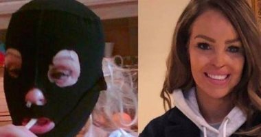 الوجه الآخر للتحدى.. صورة ملهمة لمذيعة وجهها مشوه فى تحدى الـ10 سنوات