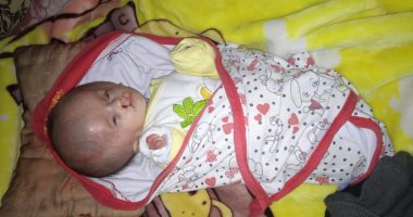صور.. استغاثة أب من الشرقية: "رأس ابنى كل يوم بتكبر ومش قادر على ثمن العملية"