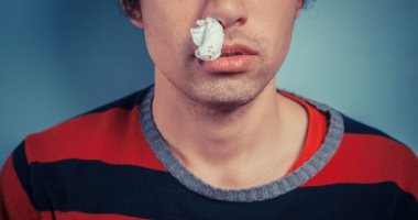 لو حصلك نزيف الأنف..إيه الاسعافات الأولية اللى ممكن تعملها؟