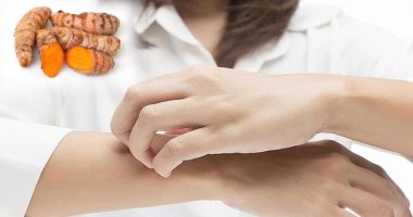 صحتك فى وصفة.. استخدم الكركم باللبن لعلاج الأكزيما