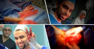 لأول مرة بالوطن العربى.. دكتور أحمد مرزوق يروى تفاصيل 4 ساعات بغرفة العمليات لاستئصال أكبر ورم من بطن سيدة حامل.. استشارى النساء والتوليد: انتزعنا ورما يزن 14كيلوجرام ولم نضح بالجنين.. وأسعى لدخول "جينيس"..صور
