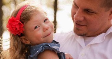 يعنى ايه متلازمة ويليامز وأعراضها على طفلك؟