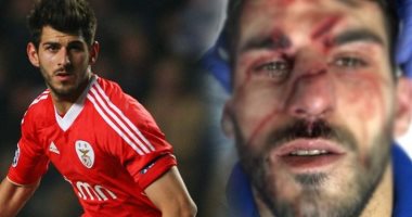 "داس على وشه".. جروح خطيرة فى وجه لاعب أثناء مباراة بالدورى الانجليزى ..فيديو