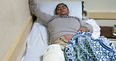 بيطرى يصاب بكسر مضاعف بعد ركل "عجل" له فى حملة تحصين