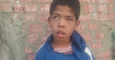 صور.. والد طفل معاق ببنى سويف: ابنى يعانى من مياه على المخ وأناشد بمعالجته