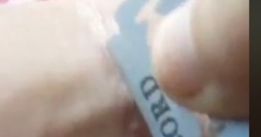 التقارير الطبية: المهتز نفسيًا بالشرقية حاول الانتحار بإصابة نفسه بشفرة حلاقة