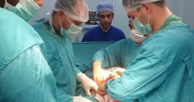 صور.. فريق طبى ينجح فى إزالة 47 حصوة من مثانة رجل أربعينى بمستشفى الغردقة 