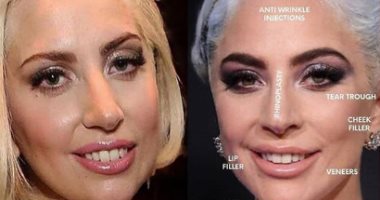 صور.. ليدى جاجا زمان غير دلوقتي و"التجميل" فرق معاها كتير  